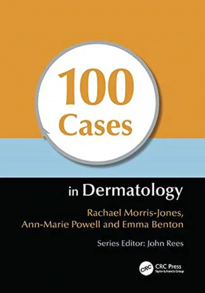 100 Cases in Dermatology | Rachael Morris-Jones
