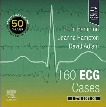 160 ECG Cases. 6 ed, Paperback/***