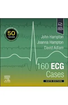 160 ECG Cases - John (emeritus Professor Of Cardiology Hampton