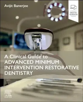 A Clinical Guide to Advanced Minimum Intervention Restorative Dentistry, Paperback/***