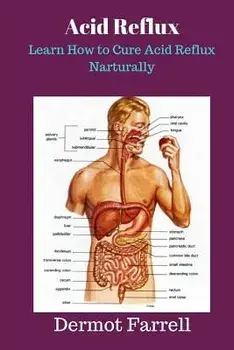 Acid Reflux: Learn How to Cure Acid Reflux Naturally, Paperback/Dermot Farrell