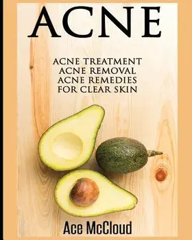 Acne: Acne Treatment: Acne Removal: Acne Remedies For Clear Skin, Paperback/Ace McCloud