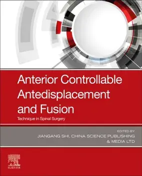 Anterior Controllable Antedisplacement and Fusion. Technique in Spinal Surgery, Paperback/***