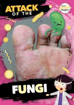 Attack of the Fungi, Paperback/William Anthony