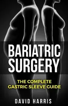Bariatric Surgery: The Complete Gastric Sleeve Guide, Paperback/David Harris