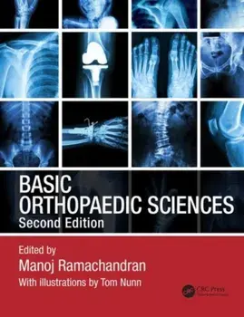 Basic Orthopaedic Sciences/***