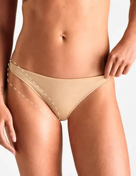 Bikini feminin extins – Epilare Definitivă cu Laser - 4 Sedinte