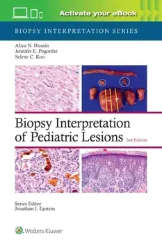 Biopsy Interpretation of Pediatric Lesions: Print + eBook with Multimedia. 2 ed, Hardback/ALIYA NOOR, M.D. HUSAIN
