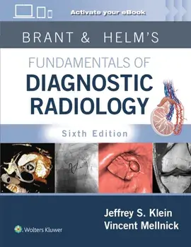 Brant & Helms' Fundamentals of Diagnostic Radiology: Print + eBook with Multimedia. 6 ed, Hardback/Vincent Mellnick