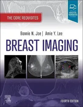 Breast Imaging. The Core Requisites, 4 ed, Paperback/***