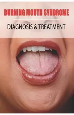 Burning Mouth Syndrome: Diagnosis & Treatment: Burning Mouth Syndrome Guide - Enoch Narciso
