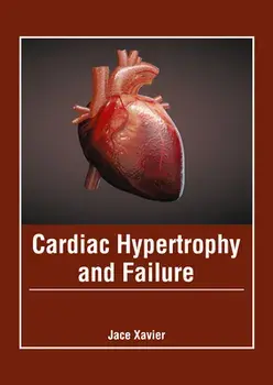 Cardiac Hypertrophy and Failure, Hardcover/Jace Xavier