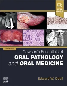Cawson's Essentials of Oral Pathology and Oral Medicine. 10 ed, Paperback/***