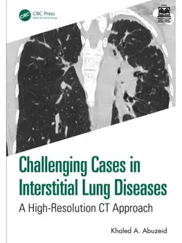 Challenging Cases in Interstitial Lung Diseases. A High-Resolution CT Approach, Paperback/Khaled A. Abuzeid