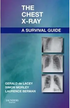 Chest X-Ray: A Survival Guide - Gerald De Lacey