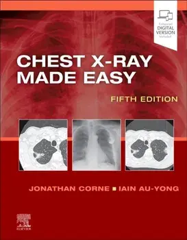 Chest X-Ray Made Easy. 5 ed, Paperback/***