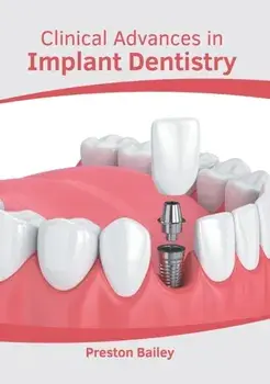 Clinical Advances in Implant Dentistry, Hardcover/Preston Bailey