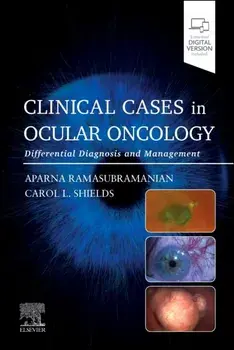 Clinical Cases in Ocular Oncology. Differential Diagnosis and Management, Paperback/***