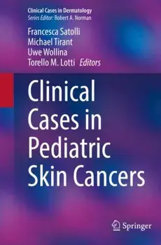Clinical Cases in Pediatric Skin Cancers. 1st ed. 2022, Paperback/***