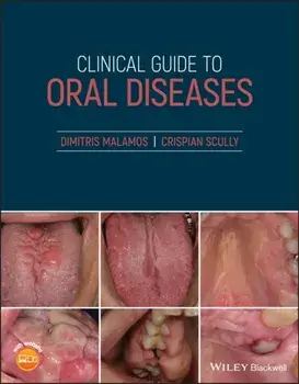 Clinical Guide to Oral Diseases, Paperback/Crispian Cbe Scully