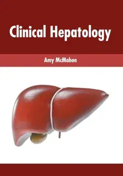 Clinical Hepatology, Hardcover/Amy McMahon