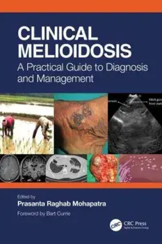 Clinical Melioidosis. A Practical Guide to Diagnosis and Management, Paperback/***