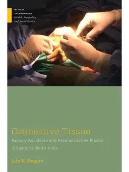 Connective Tissue. Factory Accidents and Reconstructive Plastic Surgery in South India, Paperback/Lily N. Shapiro