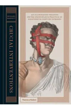 Crucial Interventions: An Illustrated Treatise on the Principles & Practice of Nineteenth-Century Surgery - Richard Barnett
