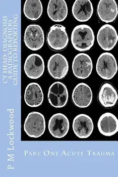 CT Head: Diagnosis a Radiographers Guide to Reporting Part 1 Acute Trauma: Part One Acute Trauma, Paperback/P. M. Lockwood