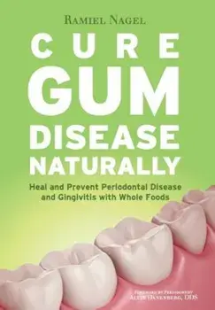 Cure Gum Disease Naturally: Heal Gingivitis and Periodontal Disease with Whole Foods, Paperback/Ramiel Nagel