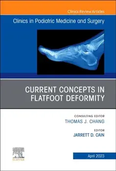 Current Concepts in Flatfoot Deformity , An Issue of Clinics in Podiatric Medicine and Surgery, Hardback/***