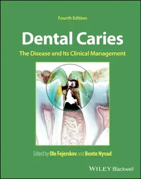 Dental Caries. The Disease and its Clinical Management, 4 ed, Hardback/***