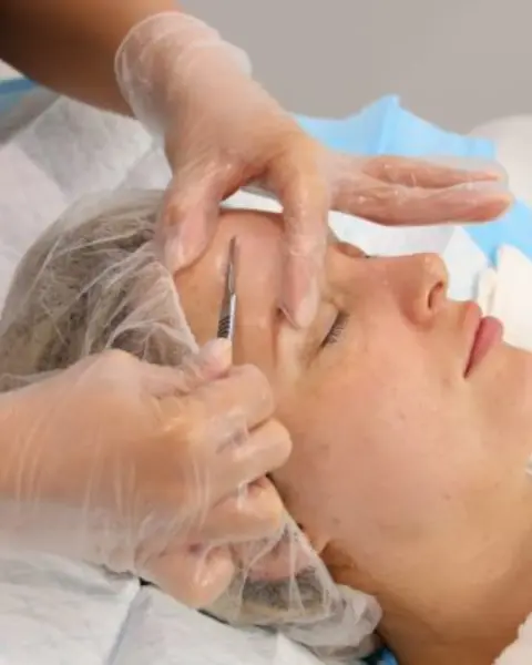 Dermaplaning – Față completă - Default Title