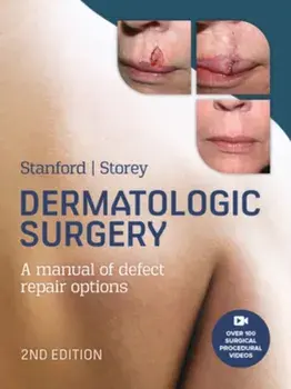 Dermatologic Surgery. 2 ed, Hardback/Leslie Storey