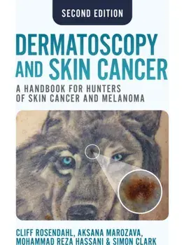 Dermatoscopy and Skin Cancer, second edition. A handbook for hunters of skin cancer and melanoma, First Edition, Second ed., Paperback/Simon Clark