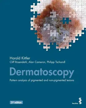 Dermatoscopy: Pattern analysis of pigmented and non-pigmented lesions, Paperback/Harald Kittler