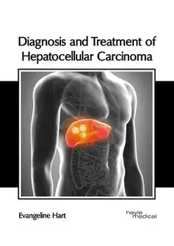 Diagnosis and Treatment of Hepatocellular Carcinoma, Hardcover/Evangeline Hart