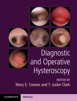 Diagnostic and Operative Hysteroscopy, Hardback/***