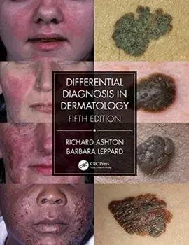 Differential Diagnosis in Dermatology, Paperback/Barbara Leppard