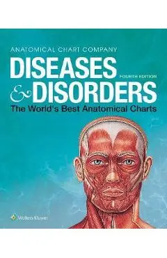 Diseases & Disorders: The World's Best Anatomical Charts - Anatomical Chart Company