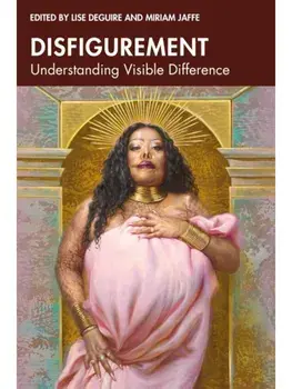 Disfigurement. Understanding Visible Difference, Paperback/***