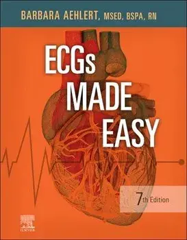 Ecgs Made Easy, Paperback/Barbara J. Aehlert
