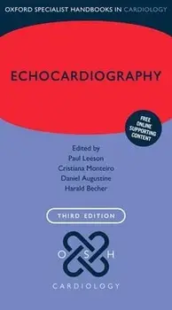Echocardiography, Paperback/Paul Leeson