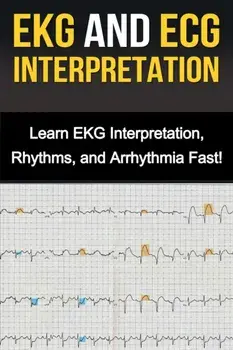 EKG and ECG Interpretation: Learn EKG Interpretation, Rhythms, and Arrhythmia Fast!, Paperback/Alyssa Stone