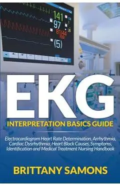 EKG Interpretation Basics Guide: Electrocardiogram Heart Rate Determination, Arrhythmia, Cardiac Dysrhythmia, Heart Block Causes, Symptoms, Identifica - Brittany Samons