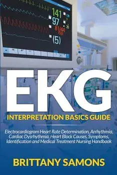 EKG Interpretation Basics Guide: Electrocardiogram Heart Rate Determination, Arrhythmia, Cardiac Dysrhythmia, Heart Block Causes, Symptoms, Identifica, Paperback/Brittany Samons