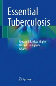 Essential Tuberculosis. 1st ed. 2021, Paperback/***