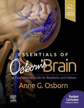 Essentials of Osborn's Brain. A Fundamental Guide for Residents and Fellows, Hardback/Anne G. Osborn