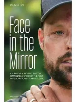 Face Transplant. How Medical Science Gave a Man a New Face and Restored His True Identity, Hardback/Jack El-Hai