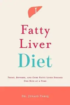 Fatty Liver Diet: Treat, Reverse, and Cure Fatty Liver Disease One Bite at a Time, Paperback/Junaid Tariq